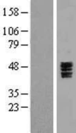Novus Biologicals&trade;&nbsp;5-HT3C Overexpression Lysate