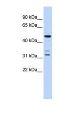 htrA4 Antibody, Novus Biologicals 0.05mg; Unlabeled:Antibodies, Polyclonal