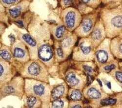 Novus Biologicals Human ESC Marker Antibody Pack 6 vials:Antibodies