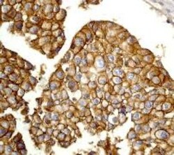 Novus Biologicals Human ESC Marker Antibody Pack 6 vials:Antibodies