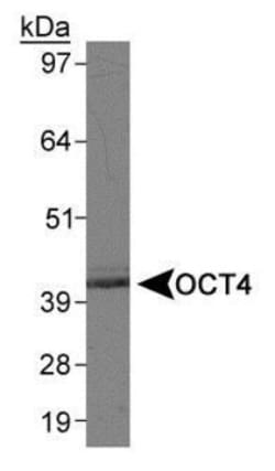 Novus Biologicals Human ESC Marker Antibody Pack 6 vials:Antibodies