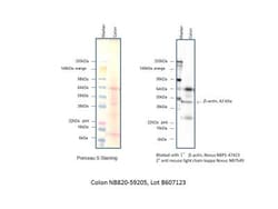 Novus Biologicals™ Human Colon Whole Tissue Lysate (Adult Whole Normal)