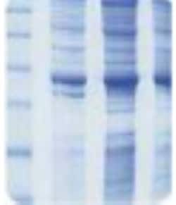 Novus Biologicals Human Colon Whole Tissue Lysate (Adult Whole Normal)