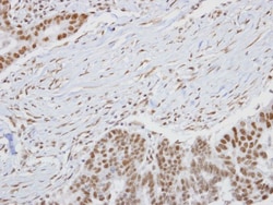 HUNK Antibody, Novus Biologicals 0.1mL; Unlabeled:Antibodies, Polyclonal