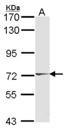 HUNK Antibody, Novus Biologicals 0.1mL; Unlabeled:Antibodies, Polyclonal