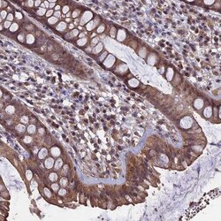 HUNK Antibody, Novus Biologicals 0.1mL; Unlabeled:Antibodies, Polyclonal