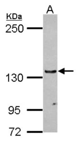 RENT1/UPF1/hUPF1 Antibody, Novus Biologicals 0.1mL; Unlabeled:Antibodies,