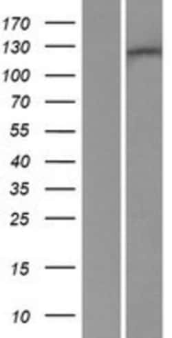 Novus Biologicals&trade;&nbsp;RENT1/UPF1/hUPF1 Overexpression Lysate