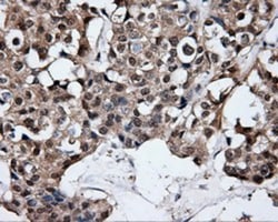 HuR/ELAVL1 Antibody (OTI14F4), Novus Biologicals 0.1mL; Unlabeled:Antibodies,