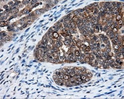 HuR/ELAVL1 Antibody (OTI14F4), Novus Biologicals 0.1mL; Unlabeled:Antibodies,