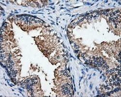 HuR/ELAVL1 Antibody (OTI14F4), Novus Biologicals 0.1mL; Unlabeled:Antibodies,