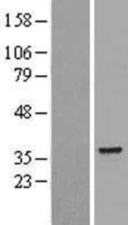 Novus Biologicals&trade;&nbsp;HuR/ELAVL1 Overexpression Lysate