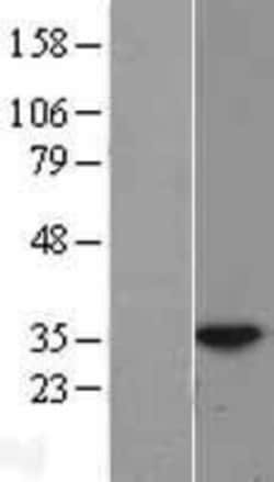 Novus Biologicals&trade;&nbsp;HUS1 Overexpression Lysate