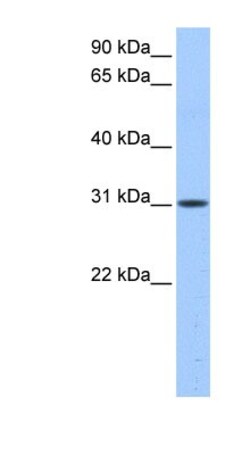 HUS1B Antibody, Novus Biologicals 20&mu;L; Unlabeled:Antibodies, Polyclonal