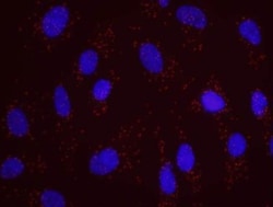 HUWE1 Antibody, Novus Biologicals 0.1mL; Unlabeled:Antibodies, Polyclonal
