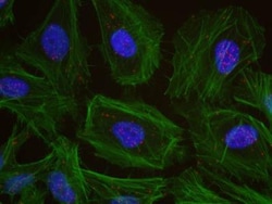 HUWE1 Antibody, Novus Biologicals 0.1mL; Unlabeled:Antibodies, Polyclonal