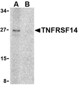 HVEM/TNFRSF14 Antibody - BSA Free, Novus Biologicals 0.1mg; Unlabeled:Antibodies,