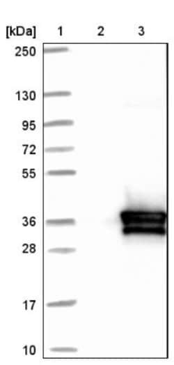 HVSL1 Antibody, Novus Biologicals 25 &mu;L | Buy Online | Novus Biologicals | Fisher Scientific