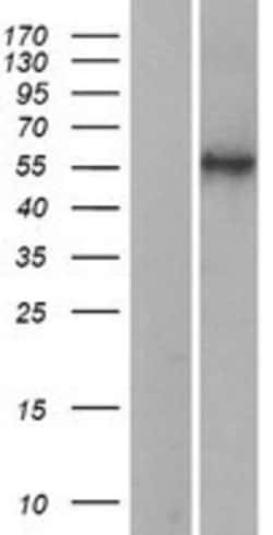 Novus Biologicals™ HYAL2 Overexpression Lysate