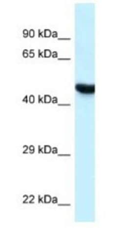 HYAL3 Antibody, Novus Biologicals 100&mu;L; Unlabeled:Antibodies, Polyclonal