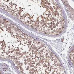 HYAL3 Antibody, Novus Biologicals 0.1mL; Unlabeled:Antibodies, Polyclonal