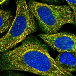 Hyaluronidase 4/HYAL4 Antibody, Novus Biologicals 0.1mL; Unlabeled:Antibodies,