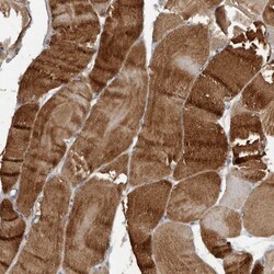 Hyaluronidase 4/HYAL4 Antibody, Novus Biologicals 0.1mL; Unlabeled:Antibodies,
