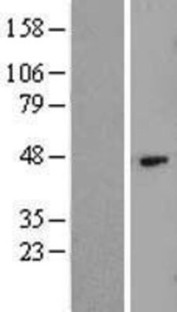 Novus Biologicals&trade;&nbsp;Hyaluronan synthase 1 Overexpression Lysate