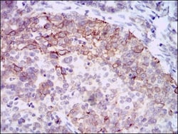 Hyaluronan Synthase 3/HAS3 Antibody (3C9) - BSA Free, Novus Biologicals