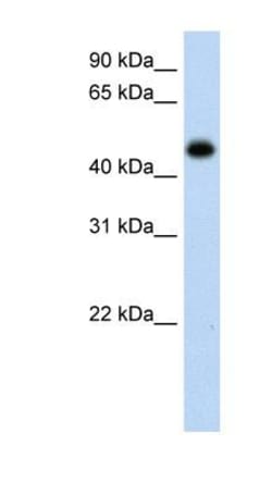 Hydroxyacid Oxidase-1/HAO-1 Antibody, Novus Biologicals 100&mu;L; Unlabeled:Antibodies,