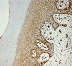 hydroxysteroid (17-beta) dehydrogenase 11 Antibody, Novus Biologicals:Antibodies:Primary