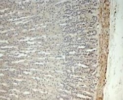 hydroxysteroid (17-beta) dehydrogenase 11 Antibody, Novus Biologicals:Antibodies:Primary