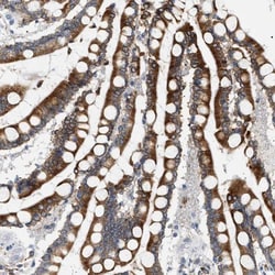 hydroxysteroid (17-beta) dehydrogenase 11 Antibody, Novus Biologicals 0.1mL;