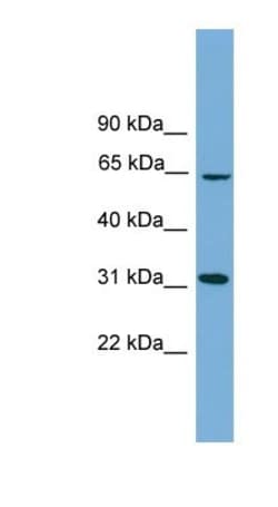 hydroxysteroid (17-beta) dehydrogenase 11 Antibody, Novus Biologicals:Antibodies:Primary