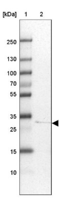 hydroxysteroid (17-beta) dehydrogenase 11 Antibody, Novus Biologicals 0.1mL;