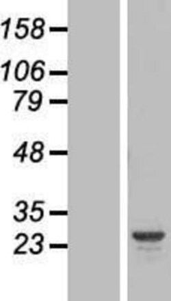 Novus Biologicals&trade;&nbsp;HYI Overexpression Lysate