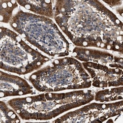 HYPE Antibody, Novus Biologicals:Antibodies:Primary Antibodies
