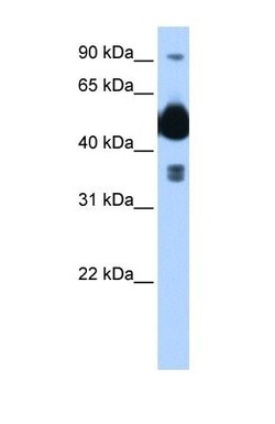 HYPE Antibody, Novus Biologicals 0.05mg; Unlabeled:Antibodies, Polyclonal