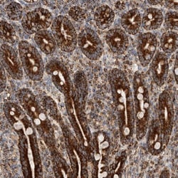 IARS2 Antibody, Novus Biologicals 25 &mu;L; Unlabeled:Antibodies, Polyclonal