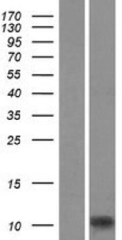 Novus Biologicals™ AIF-1/Iba1 Overexpression Lysate