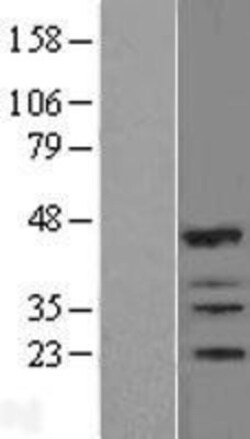 Novus Biologicals&trade;&nbsp;IBRDC2 Overexpression Lysate