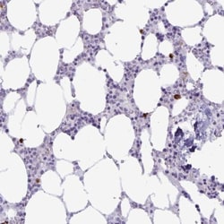 IBTK Antibody, Novus Biologicals:Antibodies:Primary Antibodies