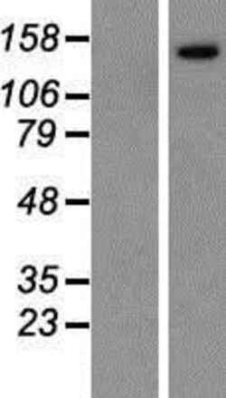 Novus Biologicals™ IBTK Overexpression Lysate