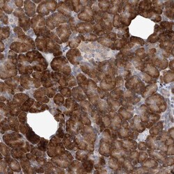 IBTK Antibody, Novus Biologicals 0.1mL; Unlabeled:Antibodies, Polyclonal