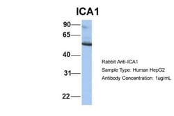 ICA1 Antibody, Novus Biologicals 100&mu;L; Unlabeled:Antibodies, Polyclonal