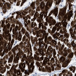ICA1 Antibody, Novus Biologicals 25 &mu;L; Unlabeled:Antibodies, Polyclonal