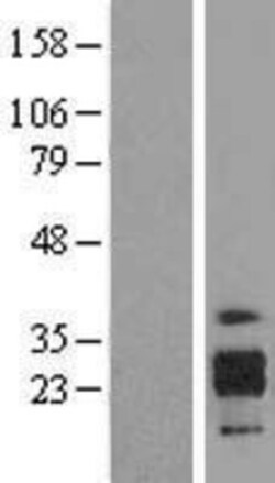 Novus Biologicals&trade;&nbsp;ICAM-4 Overexpression Lysate