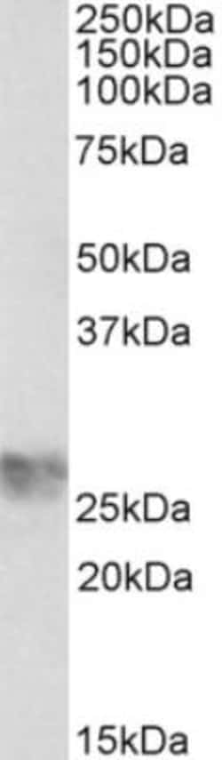 ICAM-4 Antibody, Novus Biologicals 0.1 mg | Buy Online | Novus Biologicals | Fisher Scientific