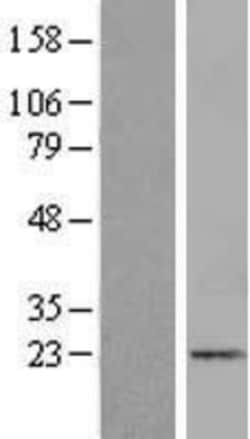 Novus Biologicals&trade;&nbsp;ICAP-1 Overexpression Lysate