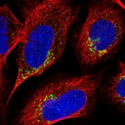 ICB1 Antibody, Novus Biologicals 25 &mu;L | Buy Online | Novus Biologicals | Fisher Scientific
